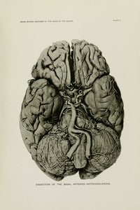 Illustrations of the gross morbid anatomy of the brain in the insane